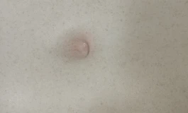 星辰171d＋妮娜头 开箱＋婚纱写真