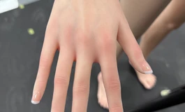 人间印象林雪160皮纹