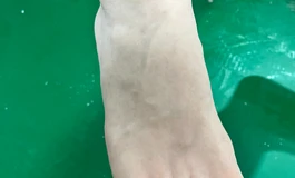 发一波手脚细节