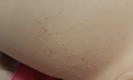 大佬们，娃娃用了一年多了，现在这个样子有办法补救吗