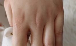 感谢，万分感谢大佬