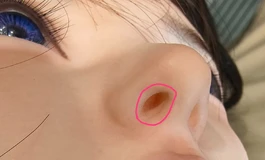 萤火日记 玲珑 口腔硬頭