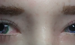 冬天不吃香菜，娃娃眼睛074