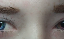 冬天吃香菜076娃娃眼睛