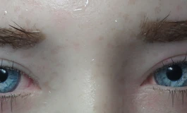 冬天吃香菜的077眼睛