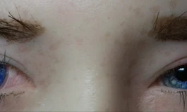 冬天吃香菜078娃娃眼睛