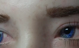 冬天吃香菜078娃娃眼睛