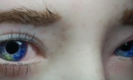 冬天吃香菜078娃娃眼睛