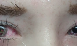 冬天吃香菜080款娃娃眼睛（哭过后的效果）