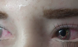 冬天吃香菜080款娃娃眼睛（哭过后的效果）