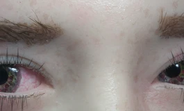 冬天吃香菜080款娃娃眼睛（哭过后的效果）