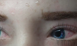 冬天吃香菜081款娃娃眼睛