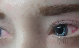 冬天吃香菜082款娃娃眼睛