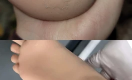 开箱一个从暴雨雨修复出院的163.5