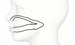 关于头雕的通道设计