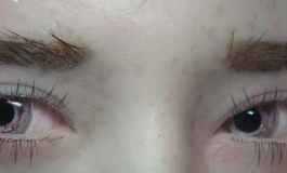 冬天吃香菜096美瞳眼