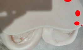 以美伦月色（亚娃）的柰子为例谈谈硅胶及tpe出现破裂时的懒人修补办法